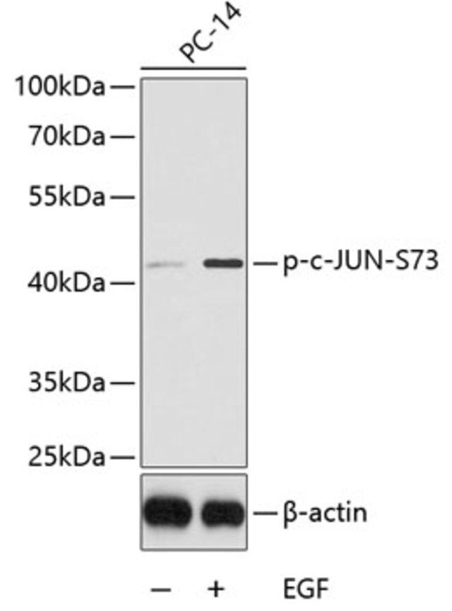 Anti-Phospho-c-Jun-S73 antibody produced in rabbit