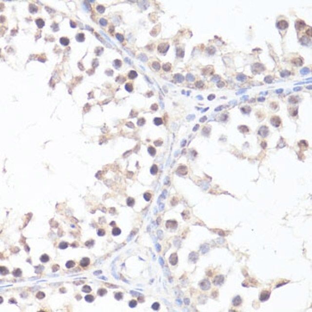 Anti-Phospho-c-Myc-T58 antibody produced in rabbit