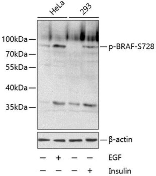 Anti-Phospho-BRAF-S728 antibody produced in rabbit