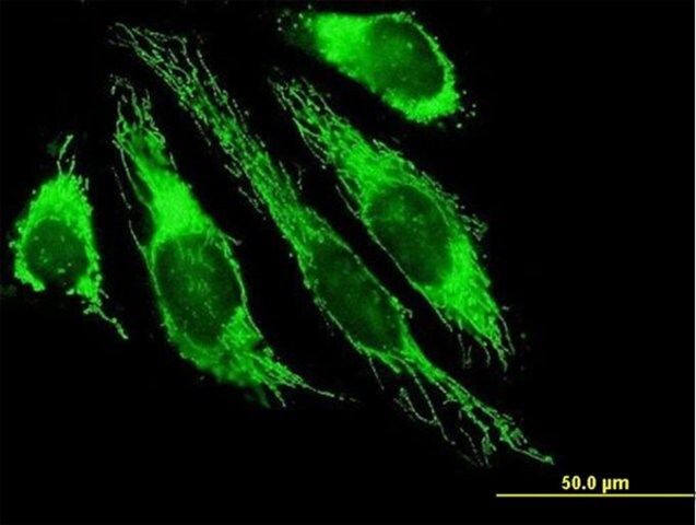 Anti-PDHB antibody produced in mouse