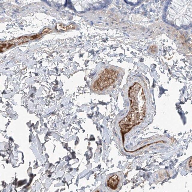 Anti-PDGFC antibody produced in rabbit