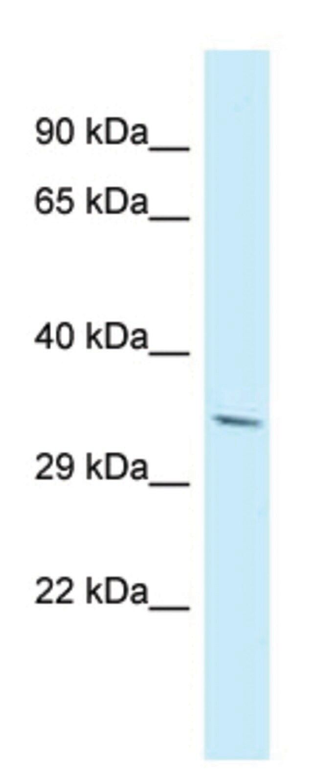 Anti-PDLIM7 (N-terminal) antibody produced in rabbit