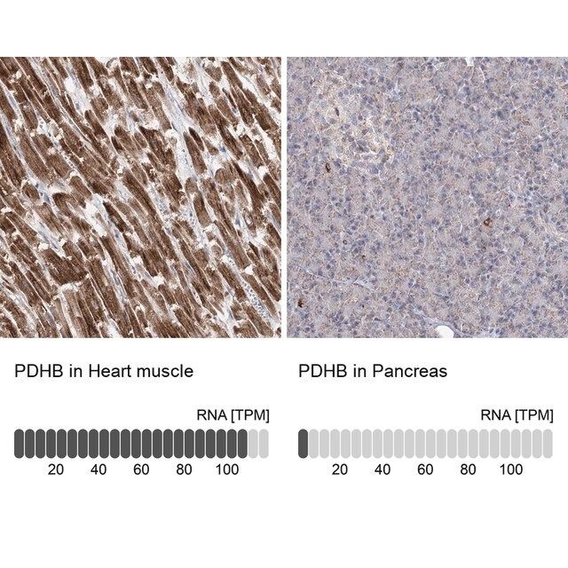 Anti-PDHB antibody produced in rabbit