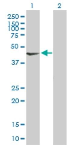 Anti-PDK2 antibody produced in mouse