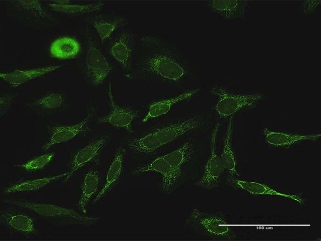 Anti-PDK4 antibody produced in rabbit