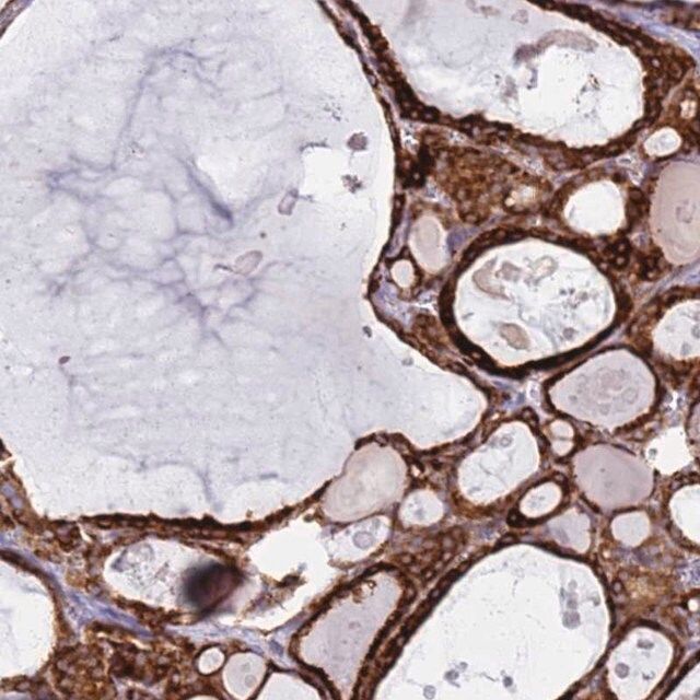 Anti-PDK3 antibody produced in rabbit