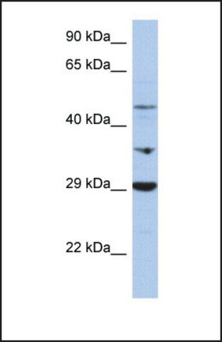 Anti-PDK3 antibody produced in rabbit