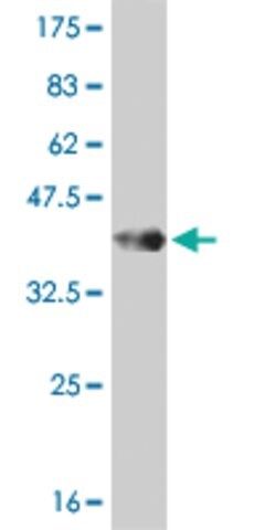 ANTI-PDK3 antibody produced in mouse
