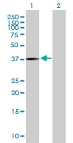 Anti-PANK3 antibody produced in mouse