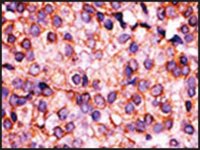 Anti-PANK3 (N-term) antibody produced in rabbit