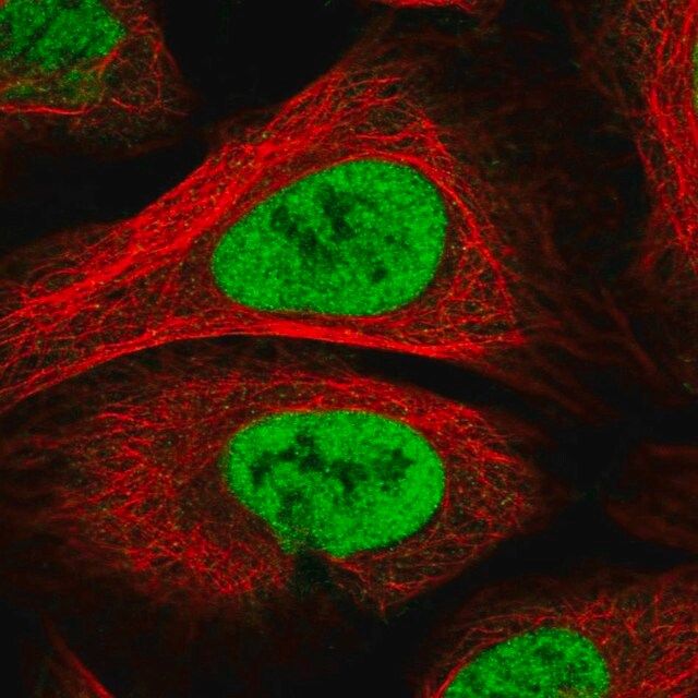 Anti-PAPOLG antibody produced in rabbit