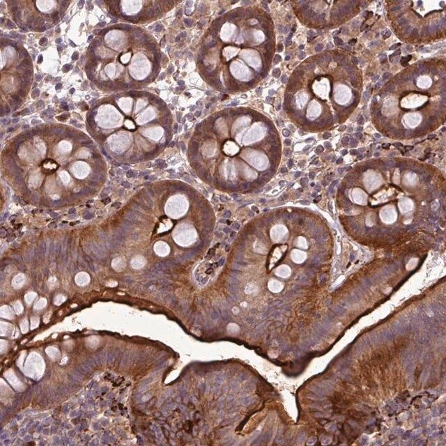 Anti-PAPLN antibody produced in rabbit