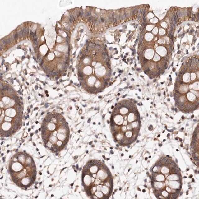 Anti-PANK4 antibody produced in rabbit
