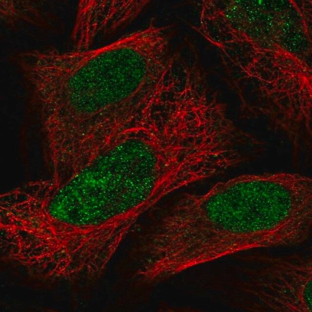 Anti-PAPOLG antibody produced in rabbit