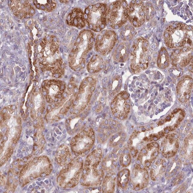 Anti-PAPD5 antibody produced in rabbit