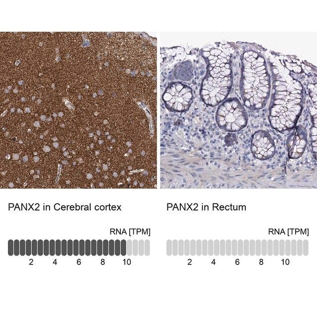 Anti-PANX2 antibody produced in rabbit