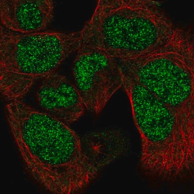 Anti-PAPLN antibody produced in rabbit