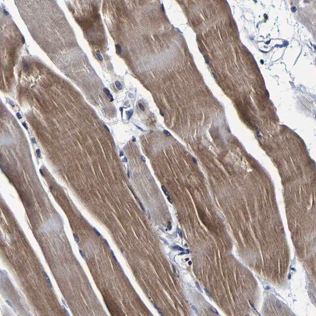 Anti-PANK4 antibody produced in rabbit