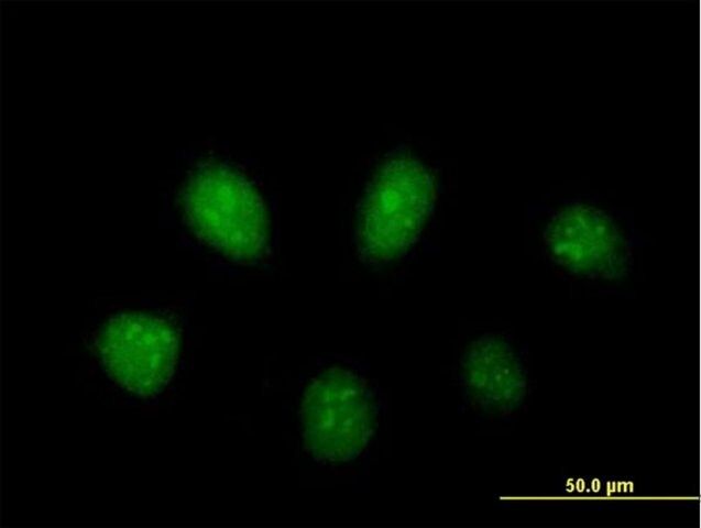 Anti-PARP3 antibody produced in mouse