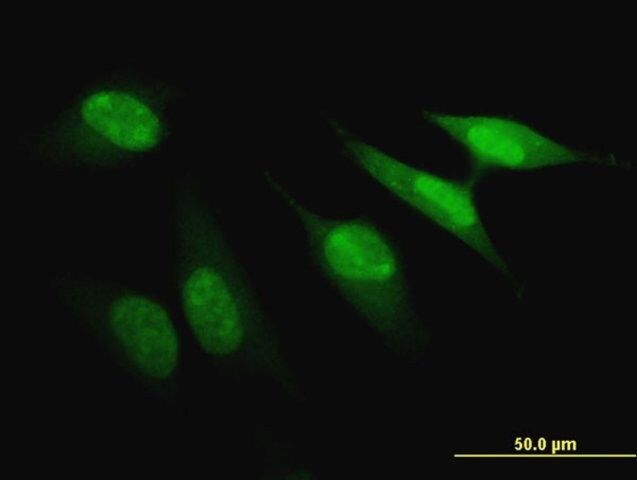 ANTI-PBK antibody produced in mouse