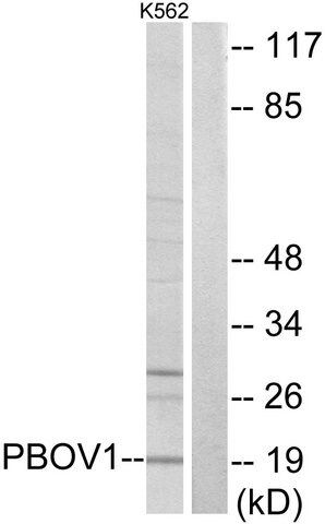 Anti-PBOV1 antibody produced in rabbit