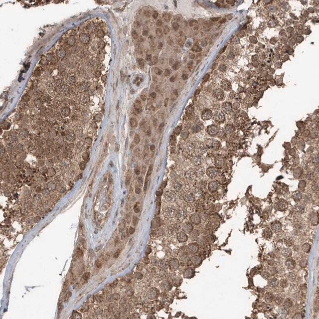 Anti-PAXBP1 antibody produced in rabbit