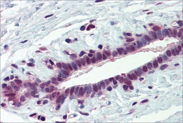Anti-PCBP1