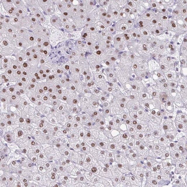 Anti-PBOV1 antibody produced in rabbit