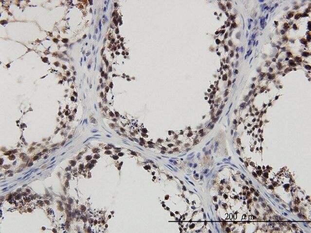 ANTI-PBK antibody produced in mouse