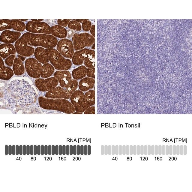 Anti-PBLD antibody produced in rabbit