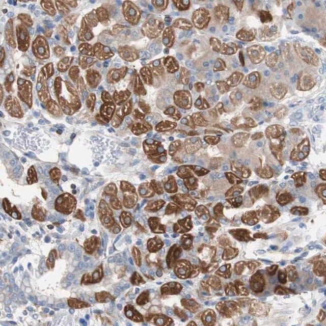 Anti-PBXIP1 antibody produced in rabbit