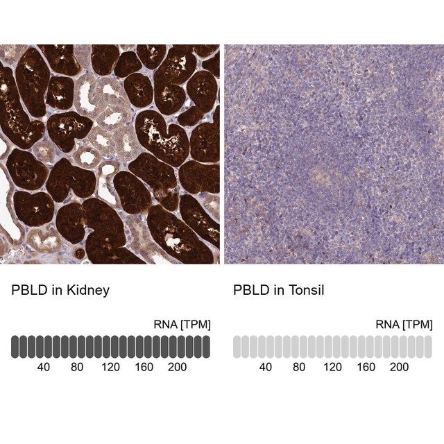 Anti-PBLD antibody produced in rabbit