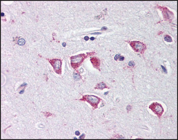 Anti-PCBP4 antibody produced in rabbit