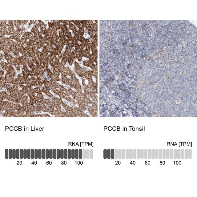Anti-PCCB antibody produced in rabbit