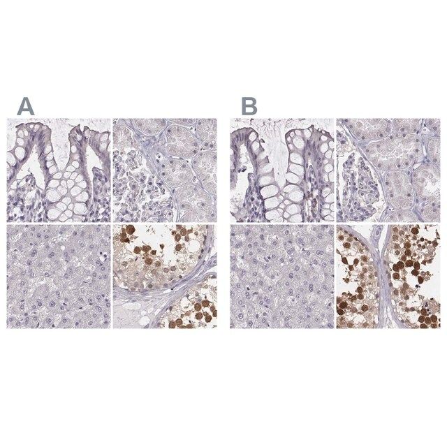 Anti-PBK antibody produced in rabbit