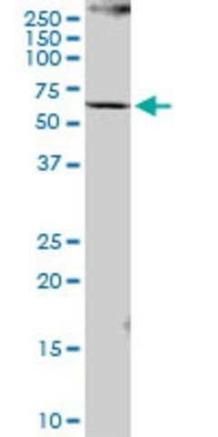 Anti-PCCB antibody produced in mouse