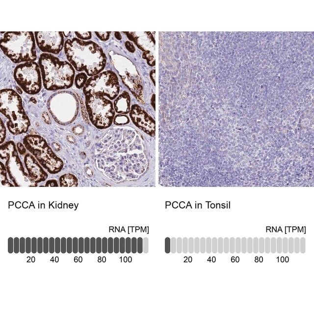 Anti-PCCA antibody produced in rabbit