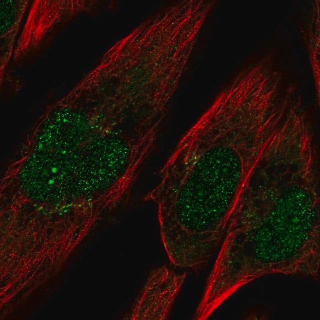 Anti-PCDH10 antibody produced in rabbit
