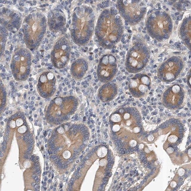 Anti-PCDH8 antibody produced in rabbit