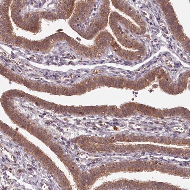Anti-PCBP2 antibody produced in rabbit