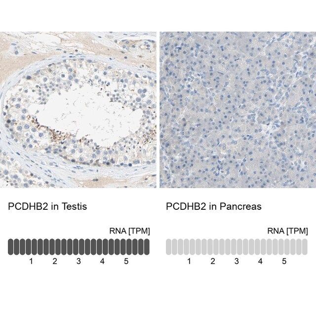 Anti-PCDHB2 antibody produced in rabbit