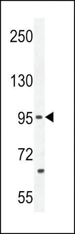 ANTI-PCDH20 (CENTER) antibody produced in rabbit