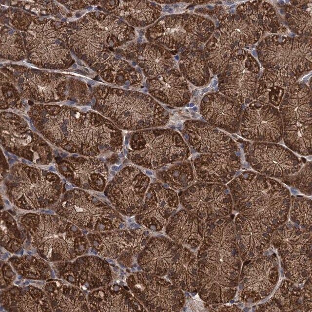 Anti-PCCA antibody produced in rabbit