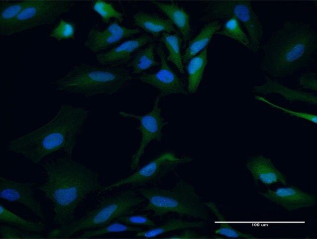 ANTI-PBK antibody produced in mouse