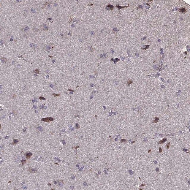 Anti-PCDHA4 antibody produced in rabbit