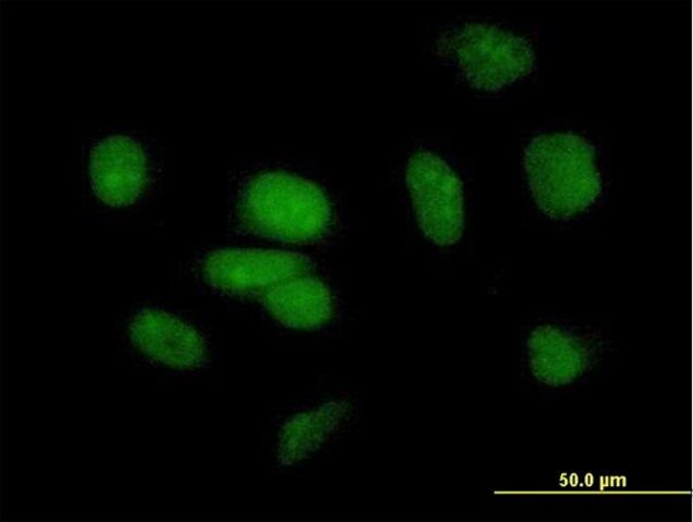 Anti-PBRM1 antibody produced in mouse