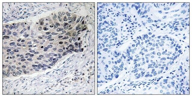 Anti-PC antibody produced in rabbit