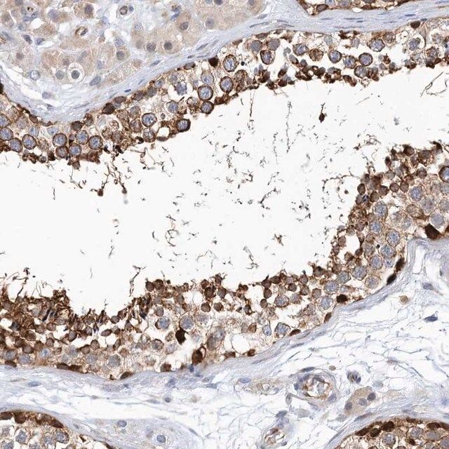 Anti-PCDHA2 antibody produced in rabbit