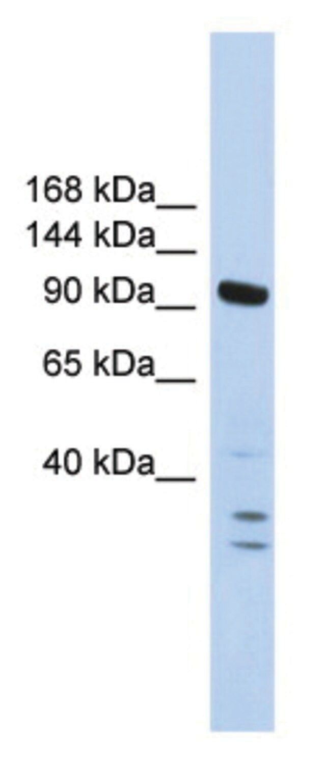 Anti-PBRM1 (N-terminal) antibody produced in rabbit