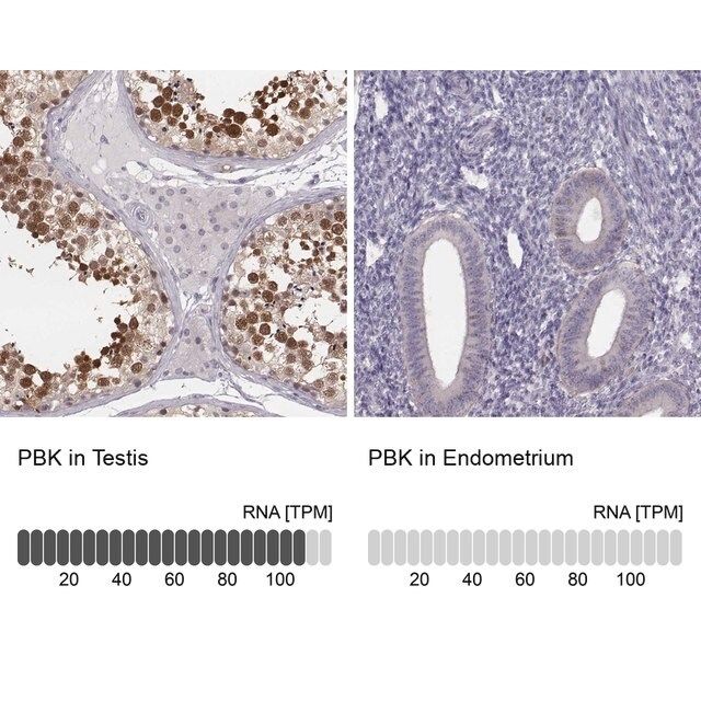 Anti-PBK antibody produced in rabbit